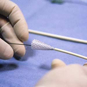 SEMS (Metallic Stents Placement)